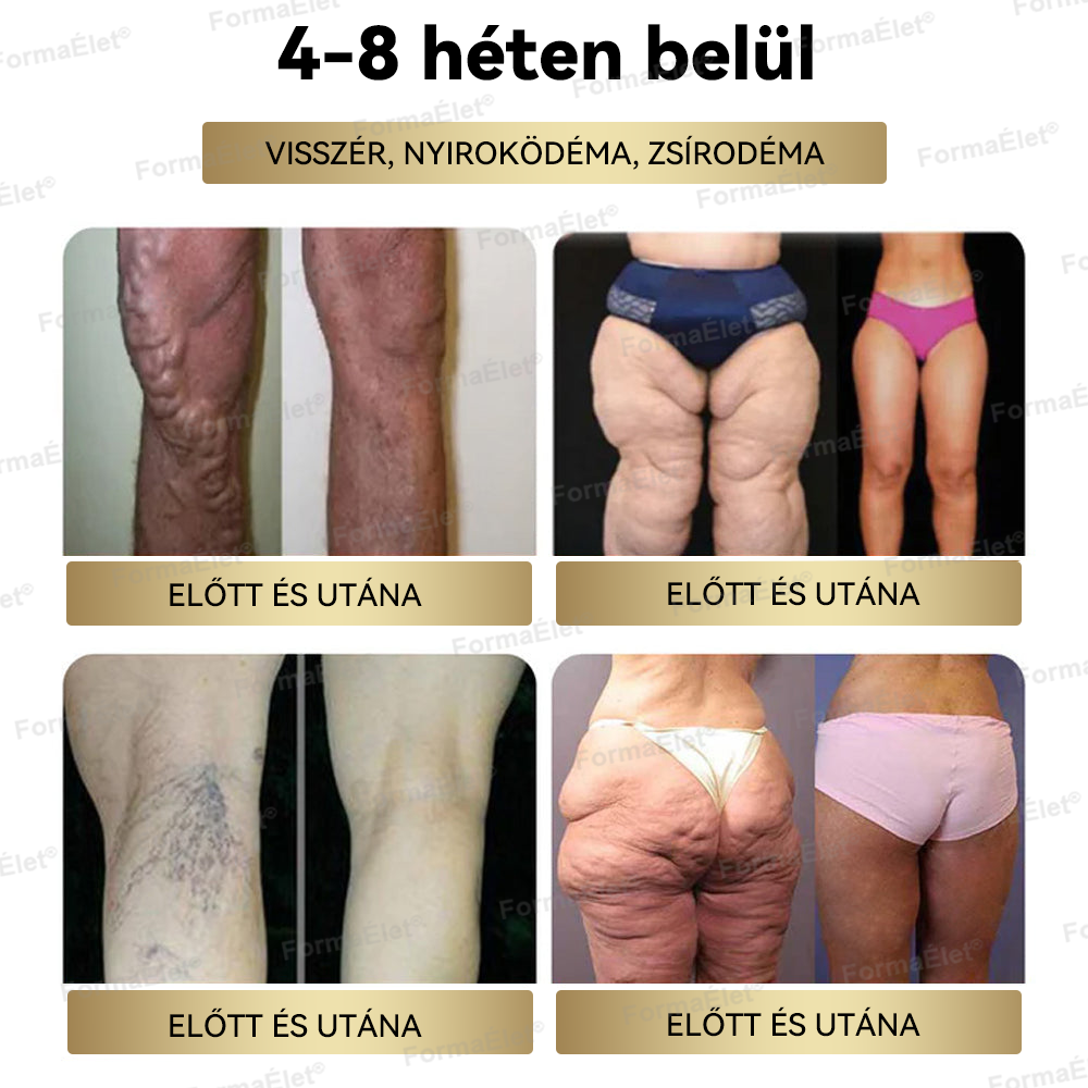 🔥🔥🔥A Mayo Clinic által ajánlott | Hivatalos üzlet | FormaÉlet® GLP-1 Moringa Fogyókúrás és Egészségfokozó cseppek 🌿 (Élelmiszer-minőségű zsírégető – Az Obesity Society fejlesztése)
