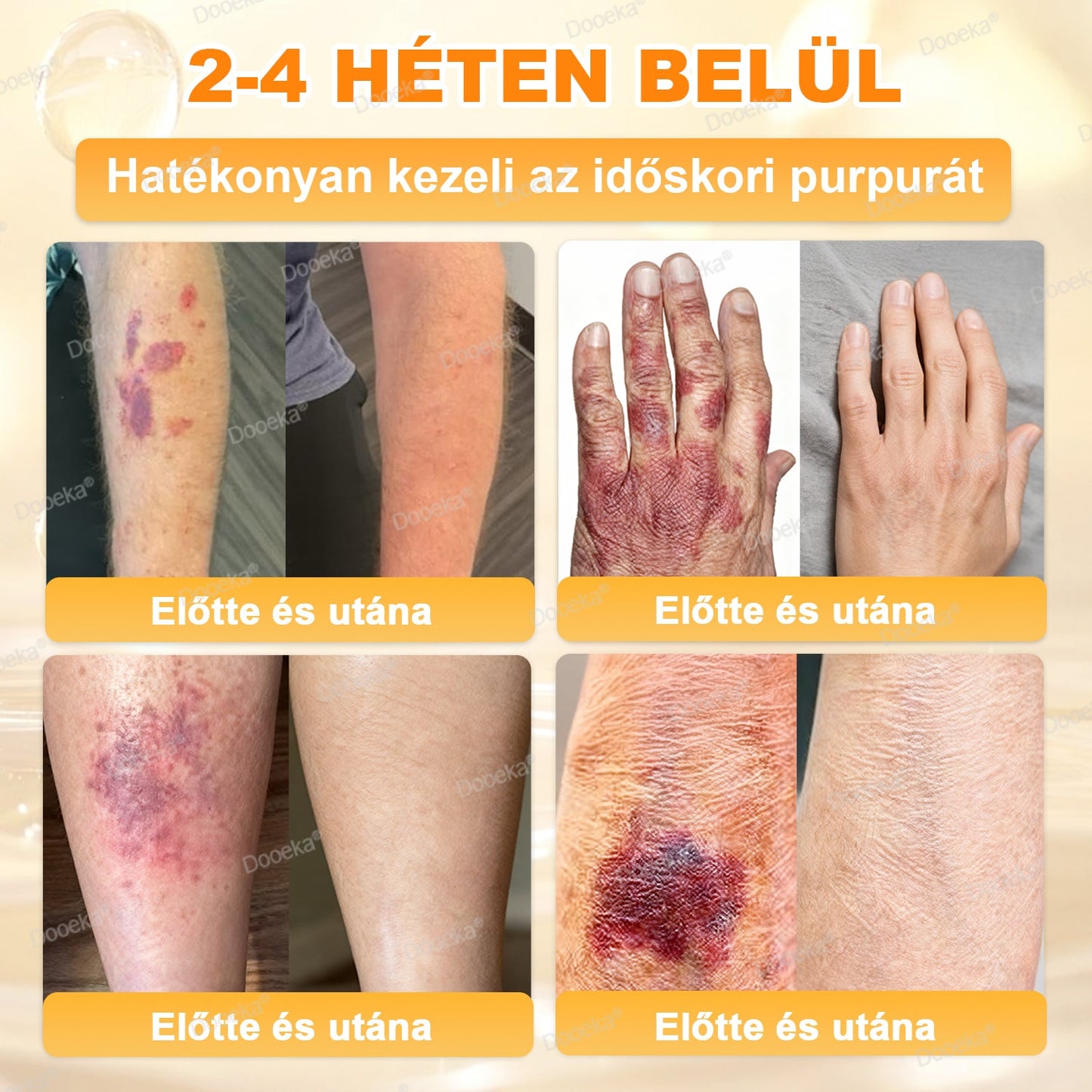 💛💛💛Dooeka® 𝟖-𝐈𝐧-𝟏 Méhméreg & Tallow Bőrfirmító és Regeneráló Krém(7 napon belül hatékony) Méhméreg + Tallow · 7X Mélyhidratálás, célozza meg a ráncokat, megereszkedést, striákat, sötét foltokat, purpurát, gyulladásokat és még sok mást.
