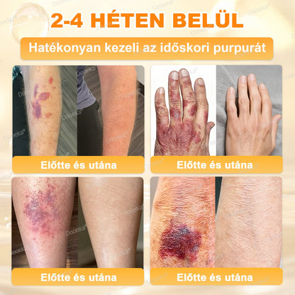 💛💛💛Dooeka® 𝟖-𝐈𝐧-𝟏 Méhméreg & Tallow Bőrfirmító és Regeneráló Krém(7 napon belül hatékony) Méhméreg + Tallow · 7X Mélyhidratálás, célozza meg a ráncokat, megereszkedést, striákat, sötét foltokat, purpurát, gyulladásokat és még sok mást.