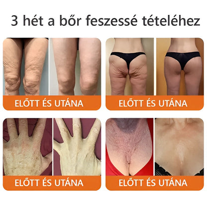 🌟🌟 ZödVita® Méhméreg Bőr Helyreállító Krém 🔥Természetes Öregedésgátló, Feszesíti a Bőrt, Csökkenti a Ráncokat– 50ml