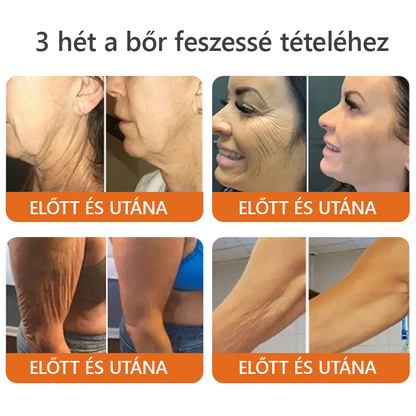 🌟🌟 ZödVita® Méhméreg Bőr Helyreállító Krém 🔥Természetes Öregedésgátló, Feszesíti a Bőrt, Csökkenti a Ráncokat– 50ml