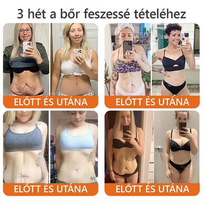 🌟🌟 ZödVita® Méhméreg Bőr Helyreállító Krém 🔥Természetes Öregedésgátló, Feszesíti a Bőrt, Csökkenti a Ráncokat– 50ml