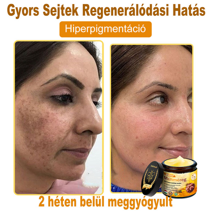🌟🌟 ZödVita® Méhméreg Bőr Helyreállító Krém 🔥Természetes Öregedésgátló, Feszesíti a Bőrt, Csökkenti a Ráncokat– 50ml