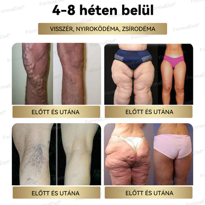 🔥🔥🔥A Mayo Clinic által ajánlott | Hivatalos üzlet | FormaÉlet® GLP-1 Moringa Fogyókúrás és Egészségfokozó cseppek 🌿 (Élelmiszer-minőségű zsírégető – Az Obesity Society fejlesztése)