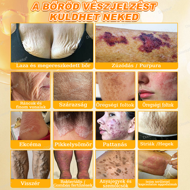 💛💛💛Dooeka® 𝟖-𝐈𝐧-𝟏 Méhméreg & Tallow Bőrfirmító és Regeneráló Krém(7 napon belül hatékony) Méhméreg + Tallow · 7X Mélyhidratálás, célozza meg a ráncokat, megereszkedést, striákat, sötét foltokat, purpurát, gyulladásokat és még sok mást.