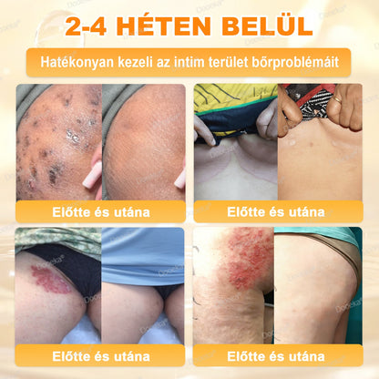 💛💛💛Dooeka® 𝟖-𝐈𝐧-𝟏 Méhméreg & Tallow Bőrfirmító és Regeneráló Krém(7 napon belül hatékony) Méhméreg + Tallow · 7X Mélyhidratálás, célozza meg a ráncokat, megereszkedést, striákat, sötét foltokat, purpurát, gyulladásokat és még sok mást.