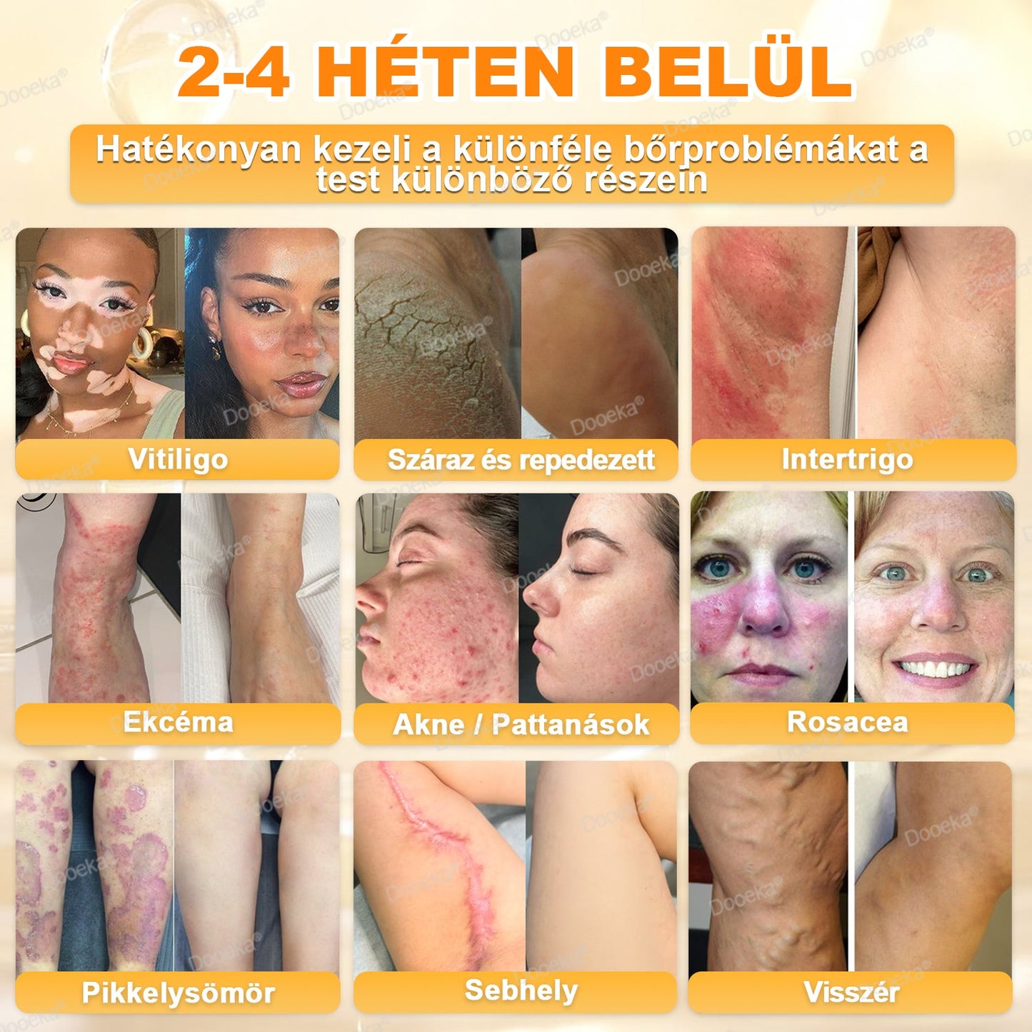 💛💛💛Dooeka® 𝟖-𝐈𝐧-𝟏 Méhméreg & Tallow Bőrfirmító és Regeneráló Krém(7 napon belül hatékony) Méhméreg + Tallow · 7X Mélyhidratálás, célozza meg a ráncokat, megereszkedést, striákat, sötét foltokat, purpurát, gyulladásokat és még sok mást.
