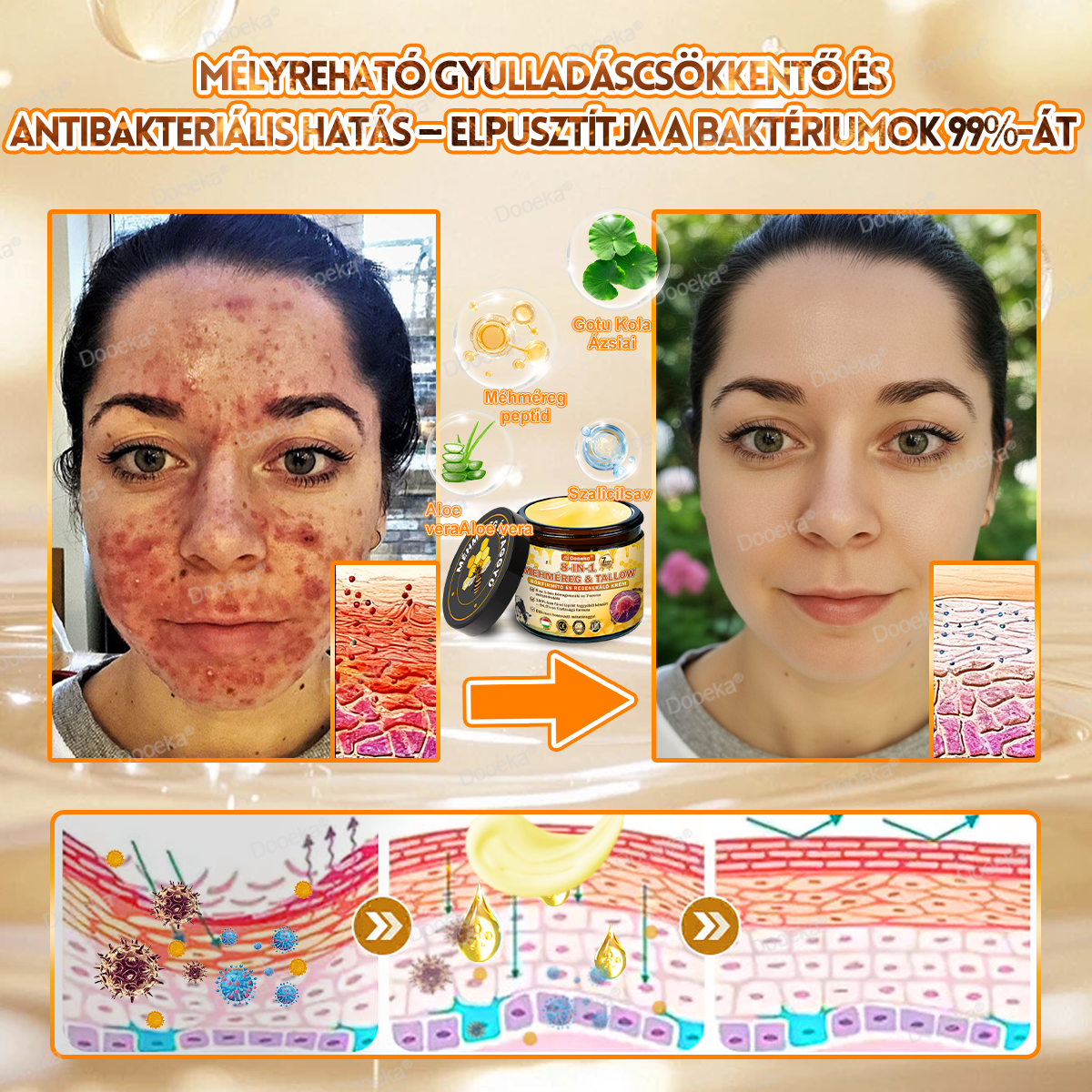 💛💛💛Dooeka® 𝟖-𝐈𝐧-𝟏 Méhméreg & Tallow Bőrfirmító és Regeneráló Krém(7 napon belül hatékony) Méhméreg + Tallow · 7X Mélyhidratálás, célozza meg a ráncokat, megereszkedést, striákat, sötét foltokat, purpurát, gyulladásokat és még sok mást.
