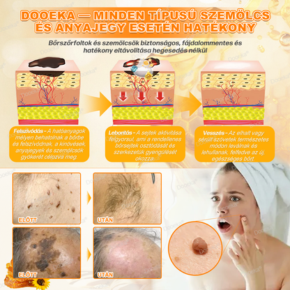 💛💛💛Dooeka® 𝟖-𝐈𝐧-𝟏 Méhméreg & Tallow Bőrfirmító és Regeneráló Krém(7 napon belül hatékony) Méhméreg + Tallow · 7X Mélyhidratálás, célozza meg a ráncokat, megereszkedést, striákat, sötét foltokat, purpurát, gyulladásokat és még sok mást.